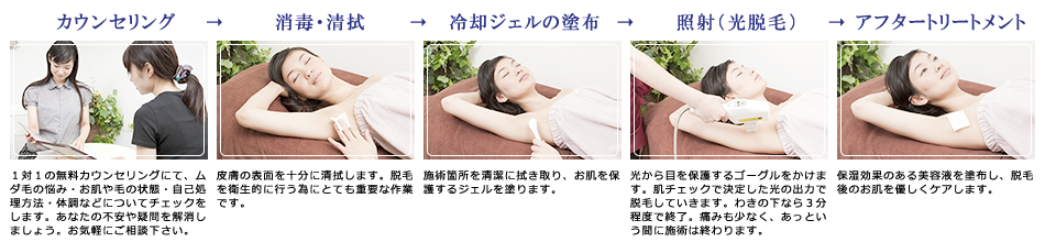 脱毛過程